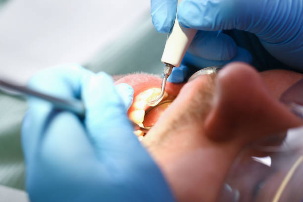Best Emergency Treatment for Toothache in Hueytown, AL