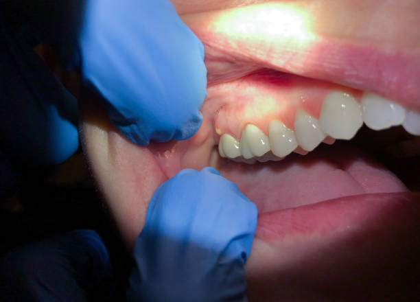 Best Walk-In Emergency Dentist in Hueytown, AL